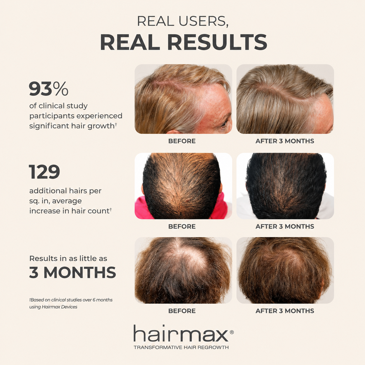 HairMax Laser Cap 272