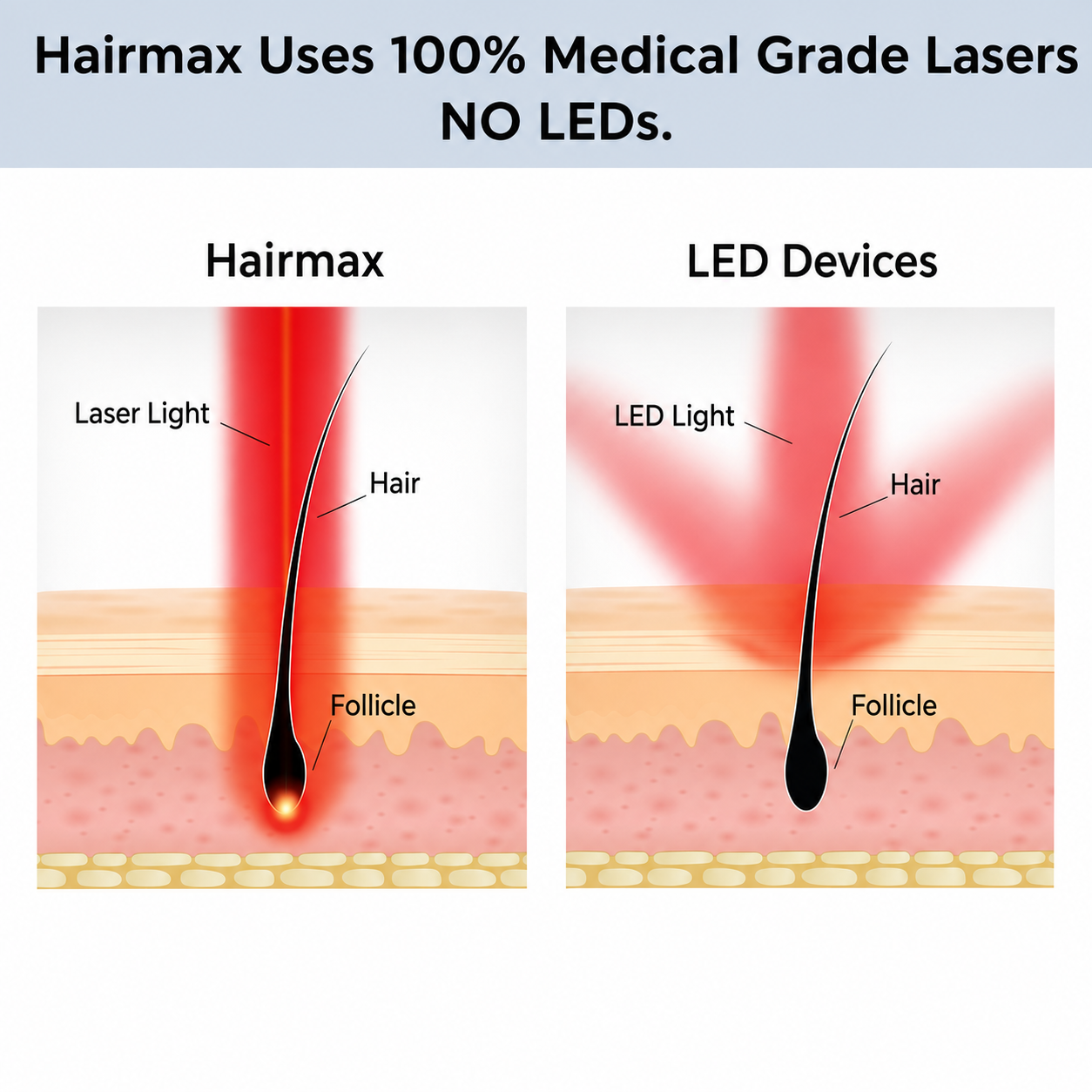 HairMax Laser Cap 272