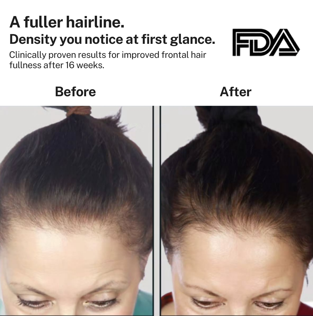 HairMax Laser Cap 272