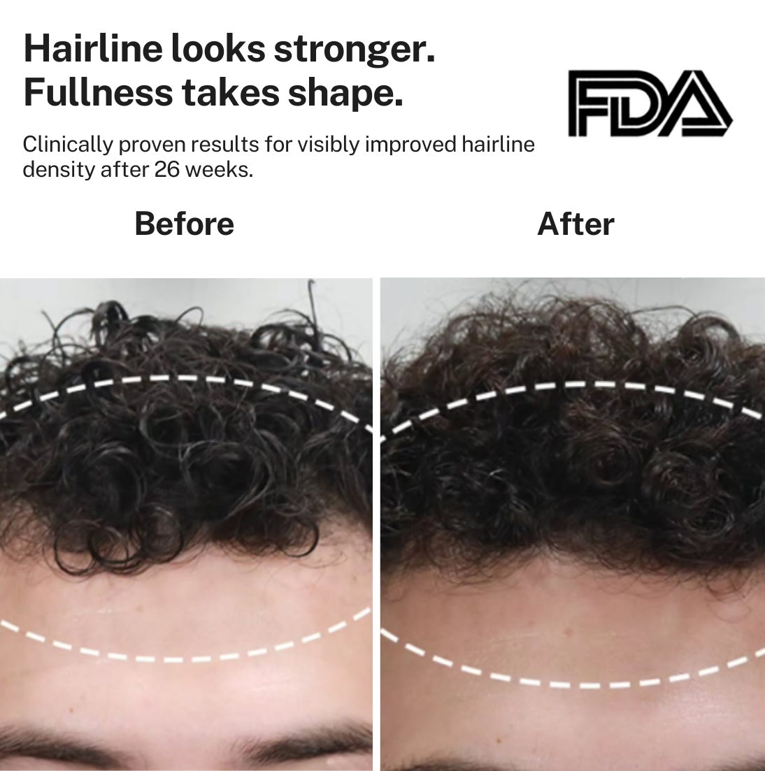 HairMax Laser Cap 272