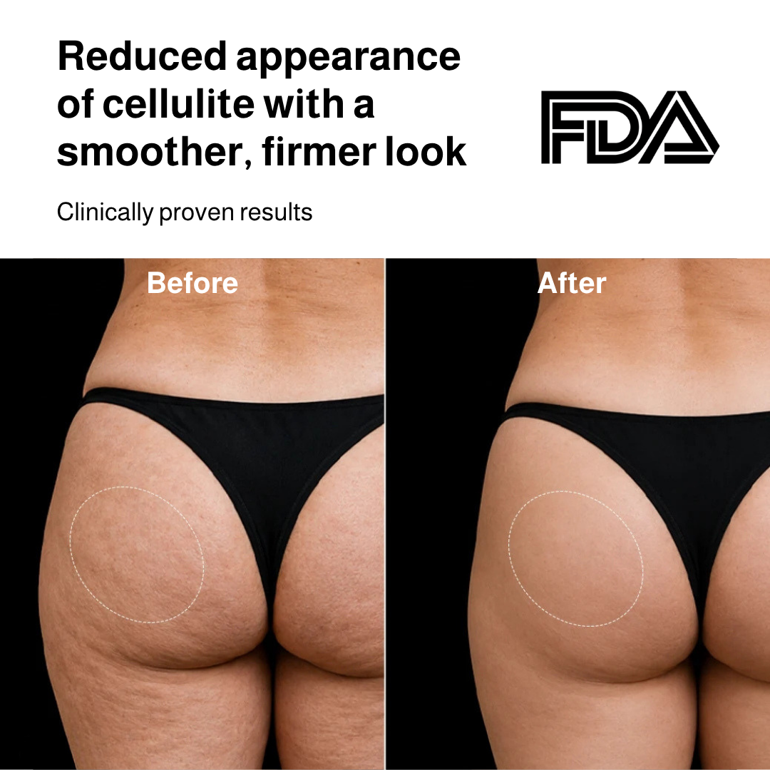Before-and-after comparison of a woman's upper arm showing skin improvement, with text reading 'Noticeably firmer, smoother-looking skin on the upper arms' and an FDA logo on a black background.